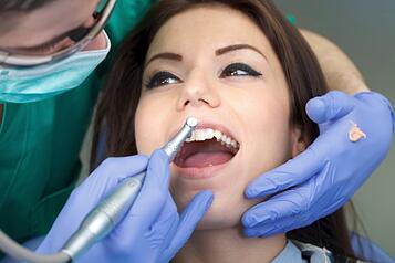 512962507_Professional_dental_brushing