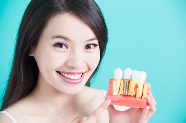 Dental Implants, what is a dental implant,what happens during a dental implant procedure, who does dental implants, does dental insurance cover implants, different types of dental implants