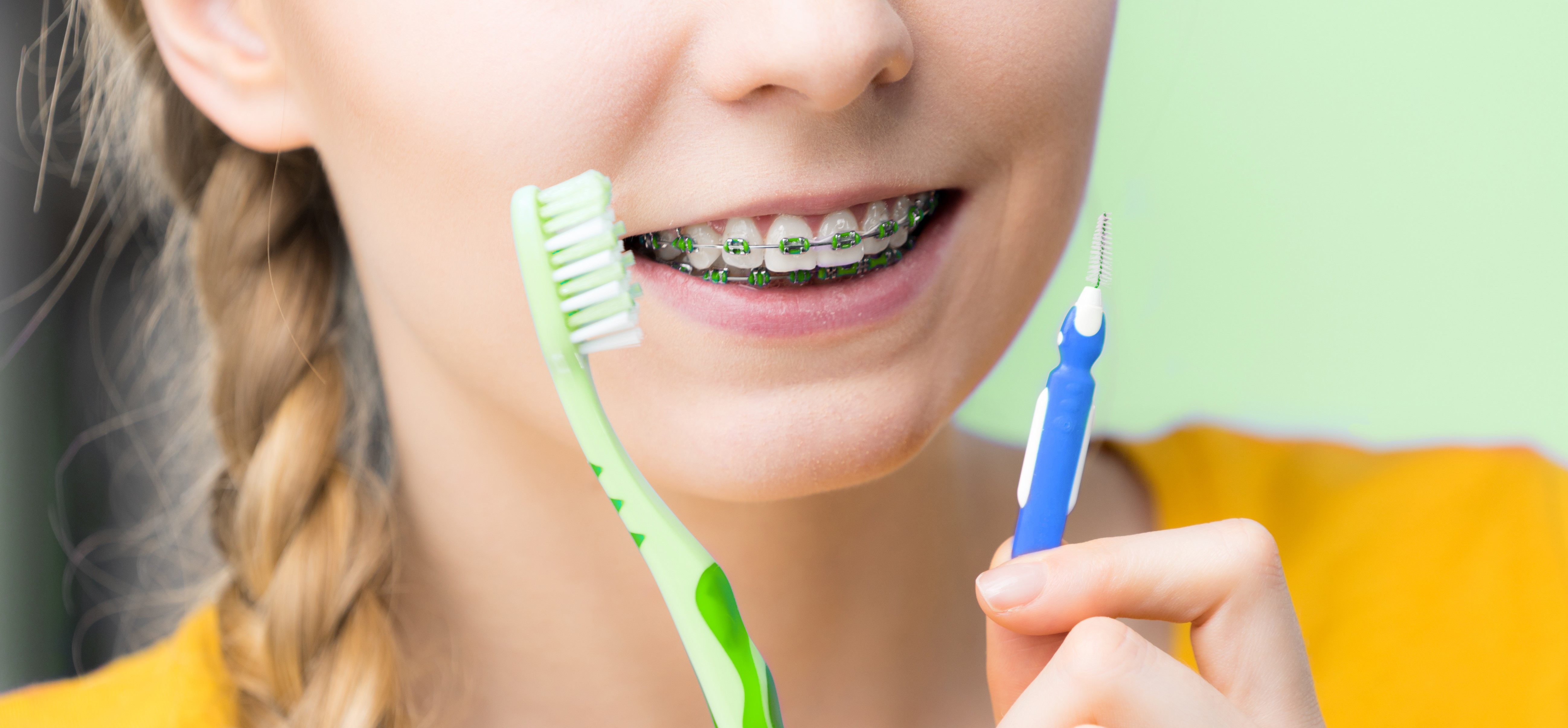 Children with autism and braces, help them prepare, autism, oral health, dental