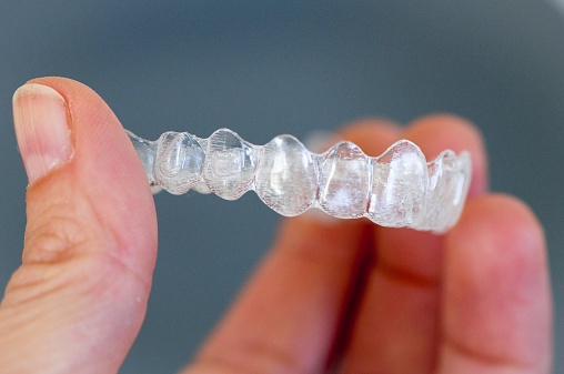 invisalign; is it worth going the extra mile