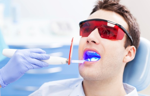 know the different types of dental fillings available to you