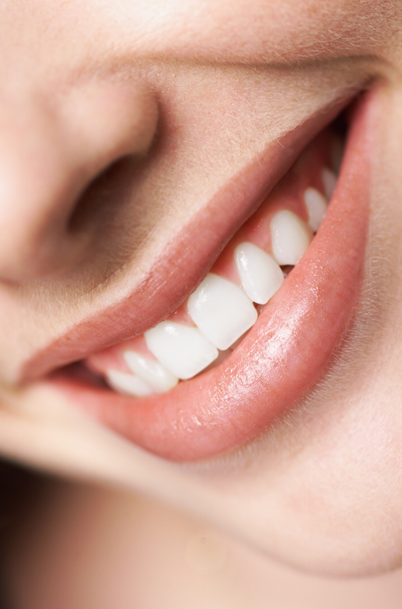 the pros and cons of dental veneers